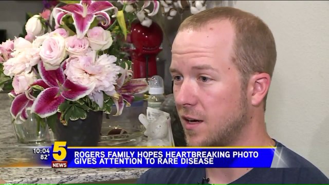 Family Hopes Heartbreaking Photo of Boy Comforting Dying Sister Raises Awareness for Rare Disease