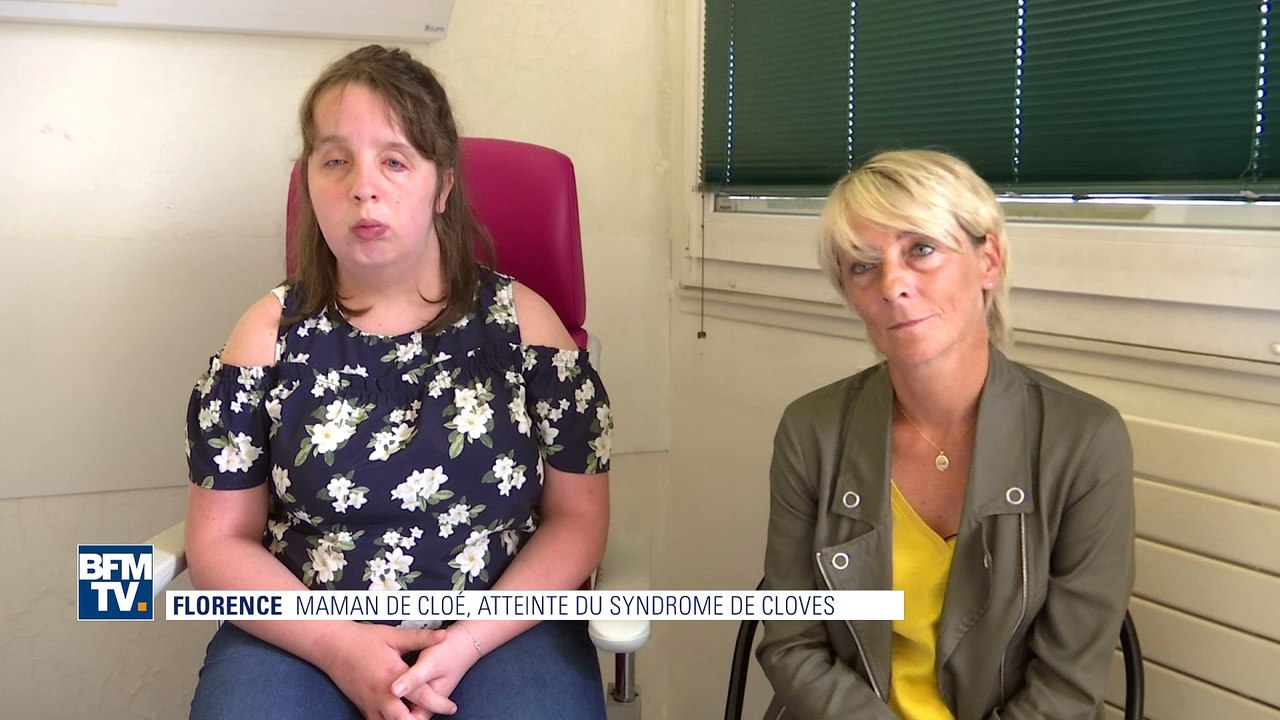 Un nouveau traitement découvert pour le syndrome de Cloves Vidéo Dailymotion