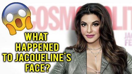 Jacqueline Fernandez Undergone Plastic Surgery? | Bollywood News