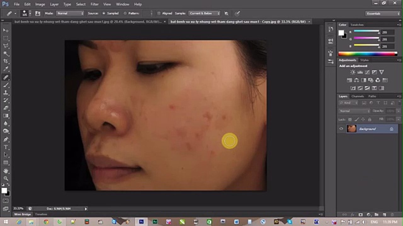 Xóa mụn bằng Photoshop Online
