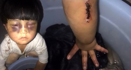 Babasının İşkence Edip Tuvalete Zincirlediği 4 Yaşındaki Kızı, Eve Gelen Misafir Kurtardı