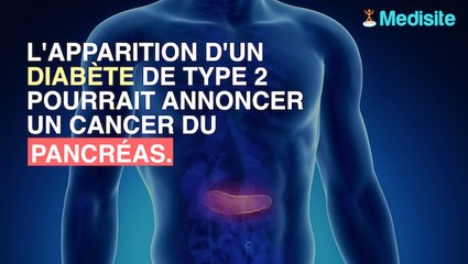 Diabète : un signe annonciateur du cancer du pancréas ?