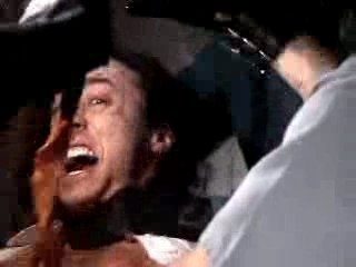 Impaled - Operating theatre