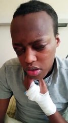 Wiilkaan Soomaaliga ah magaciisu waa Mustafa Yuusuf Xasan waxa uu degan yahay wadanka Jarmalka, Nin Eriteriyaan ah ayaa bishii Oktober cunaha tooreey ka geliyay