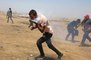 Ağzına Gaz Bombası İsabet Eden Filistinli, Tedavi İçin Gazze'den Çıkmayı Bekliyor