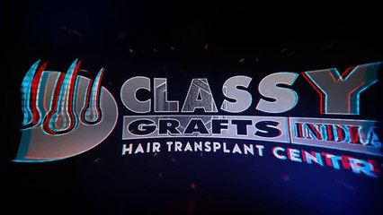 Affordable Hair Transplant in Bangalore