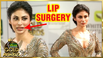 Mouni Roy SHOCKING LIP SURGERY | Zee Gold Awards 2018