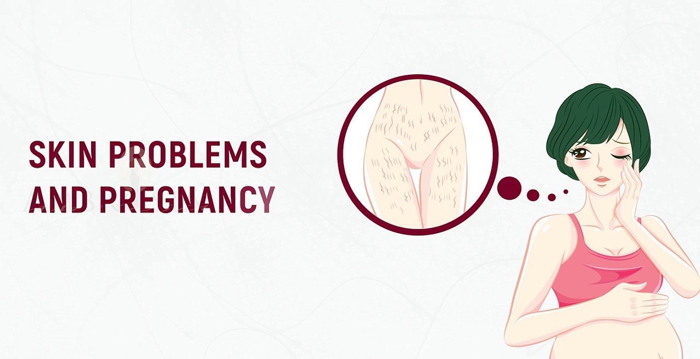 Skin Problems During Pregnancy