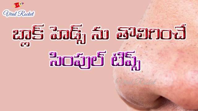 How to Remove Blackheads From Nose and Face Naturally at Home | Viral Rocket