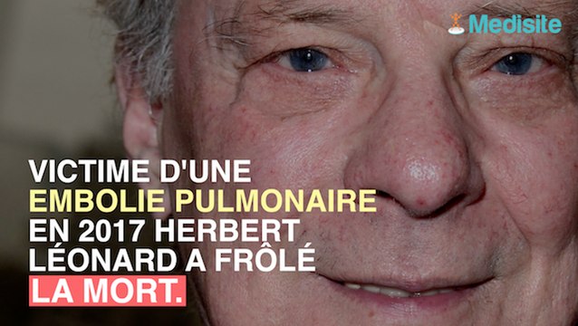 Herbert Léonard a frôlé la mort 2 fois pendant son coma