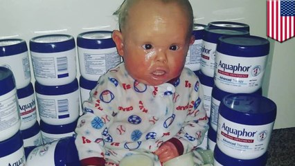 Mother must wash baby in bleach to keep him healthy