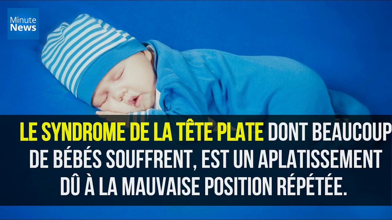 Le syndrome des bébés à tête plate dans la ligne de mire des professionnels de santé