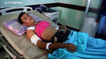 Υεμένη: Δραματική η κατάσταση στα νοσοκομεία