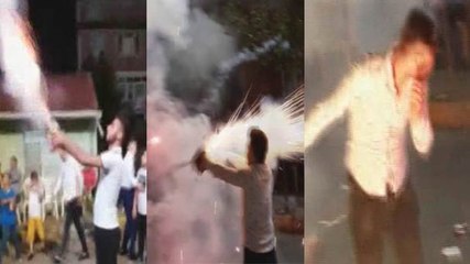 Sokak Düğününde Havai Fişek Genç Adamın Suratında Patladı!