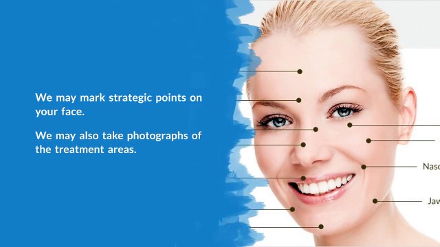 Dermal Fillers Procedure – Canada MedLaser Clinic