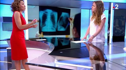 Santé : plus de quatre cancers sur dix liés à notre mode de vie