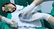 Cinsel Organı Olmadan Doğan Kadına Balık Derisinden Cinsel Organ Yapıldı