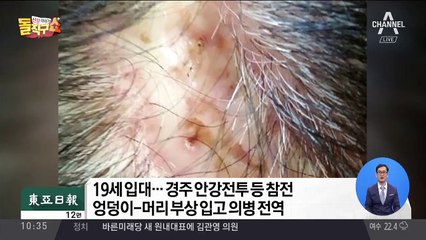 “6·25 총상 생생한데 유공자 안된다니…” 노병의 눈물