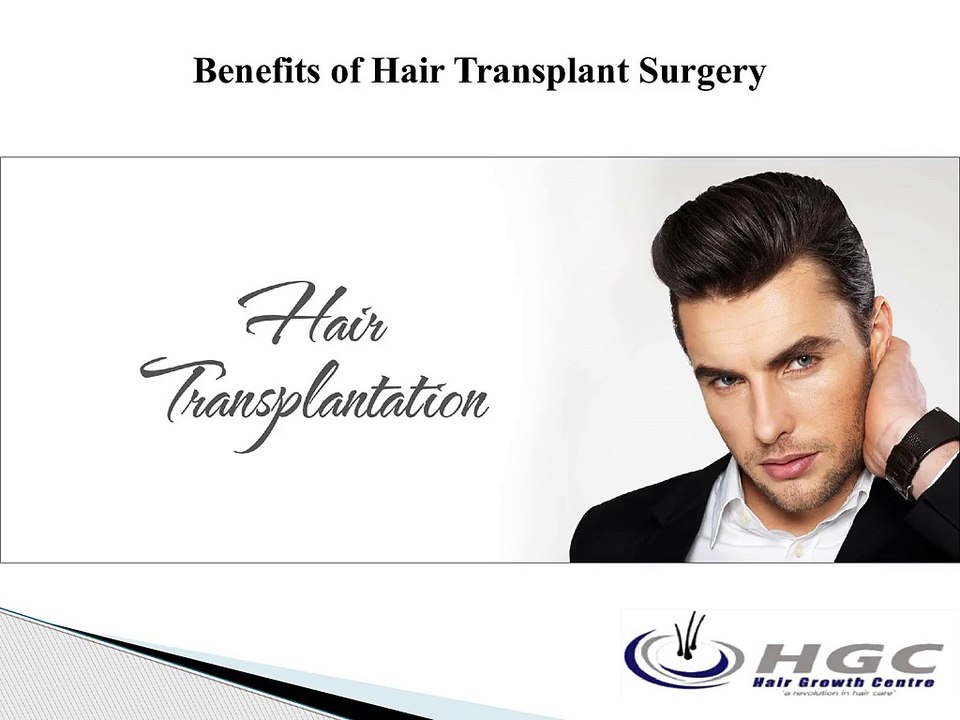 Benefits of Hair Transplant Surgery