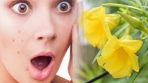 Oleander (कनेर) Flower to cure Pimples: कनेर के फूल से ऐसे जल्दी ठीक हो जातें है Pimples | Boldsky