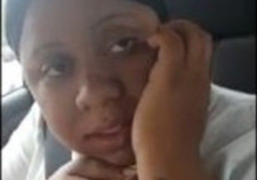 Hilarious Woman Freaks Out After Wisdom Teeth Removal