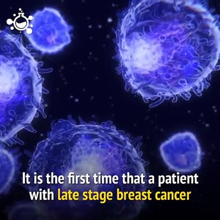 Woman Cured Of Advanced Breast Cancer Using Her Own Immune Cells.