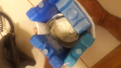 'Hastanede Parmağı Kesilen Bebek' Olayına İnceleme Başlatıldı