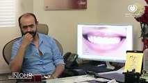 شكر خاص جداً للدكتور نور الدين مصطفى Dr.Nour - Whity Dental Clinic عضو الكونجرس العالمي لزراعة الأسنان جامعة نيويورك، وعضو الجمعية الأمريكية لتجميل الأسنان مدرب