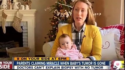 لاحظت الأم أن ضحكة طفلتها غريبة . عندما شاهدها الطبيب، أصيب بالخوف والفزع !!