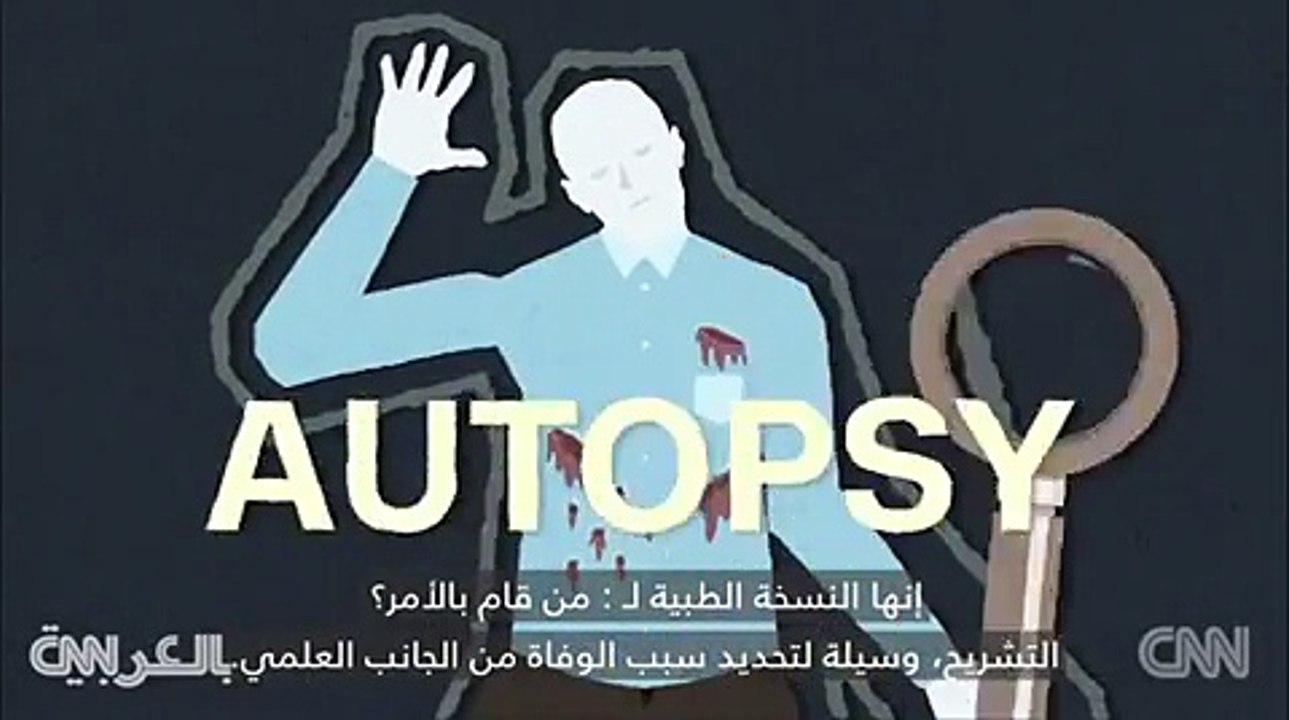 فيديو هكذا تتم عملية التشريح.. معلومات تعرفها ل...