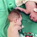طفل مبتور اليدين يطعم أخيه الرضيع بهذه الطريقة المؤثرة