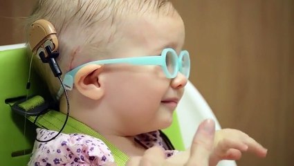 شاهد.. رد فعل مؤثر لرضيعة صماء تسمع صوت والدتها لأول مرة في حياتها