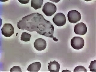 فيديو نادر لـ كرية بيضاء تهاجم بعض الفيروسات في جسم الإنسان!