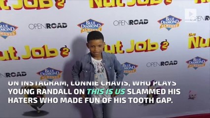‘This Is Us’ Star Lonnie Chavis Slams Trolls Who Mock His Teeth