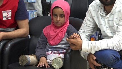 Suriyeli Maya protez tedavisi için Türkiye'de (1) - İSTANBUL