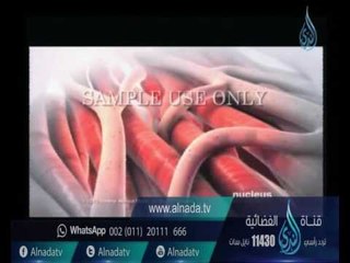 الذبحة الصدرية (السكتة القلبية ) | كشف مستعجل | الدكتور جمال شعبان 13-10-2016