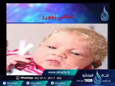 هل من الممكن أن يلد الزوجين طفل غير مشابه لهم