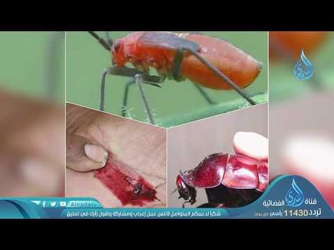 هل تعلم أنك تأكل حشرة كل يوم تقريبا دون أن تعلم ؟ | د.أحمد رمزي