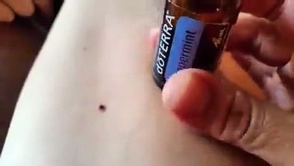 Removing Ticks with Oil