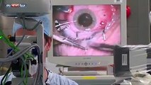 روبوتات قادرة على إجراء عمليات جراحية للعيونهل تقبل أن يقوم روبوت بعملية جراحية في عينيك؟