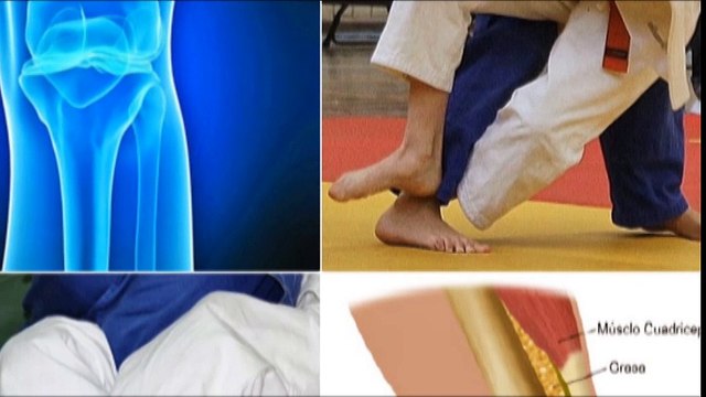 Descubre cómo cuidar de las rodillas con Maria Eugenia Baptista Zacarías