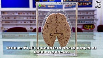 Ghê rợn bí ẩn bảo tàng não người đầu tiên ở Ấn Độ