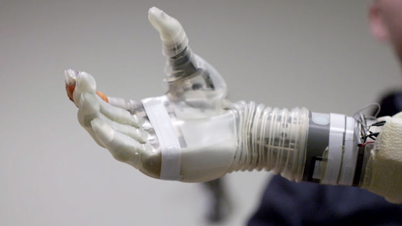 A Robotic Arm Controlled by the Mind