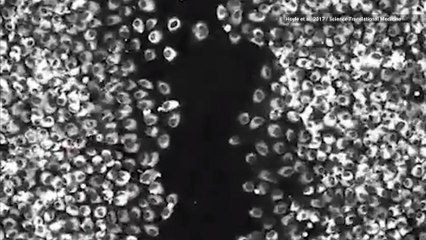 You’ll Heal Faster if You Get Injured at this Time of Day