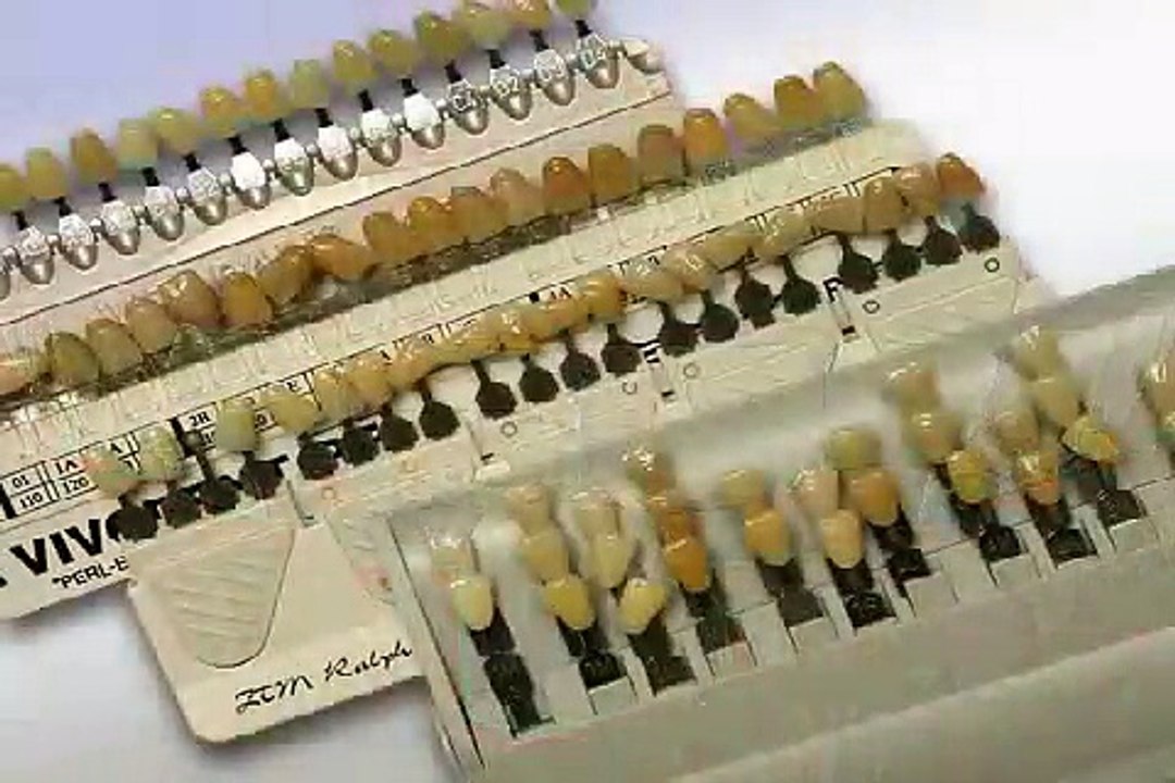 Welche Farbe haben meine Zähne - Farbwahl beim Zahnarzt