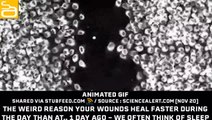 The Weird Reason Your Wounds Heal Faster D...