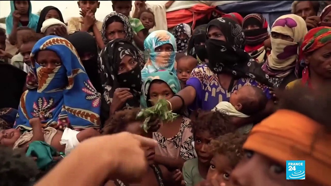 Yemen: Up to 85.000 children dead from malnutrition, starvation