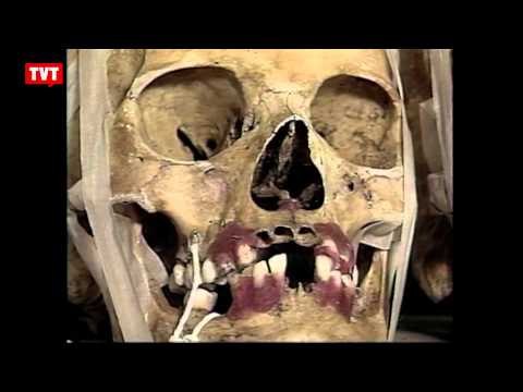 Peritos retomam apuração sobre ossadas da Vala de Perus