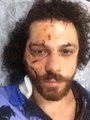 Kadıköy'de Eğlence Mekanını Tarayan Saldırganlar Ünlü Oyuncu Oral Özer'i Öldüresiye Dövdü