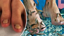 Woman's toenails fall off after fish pedicure